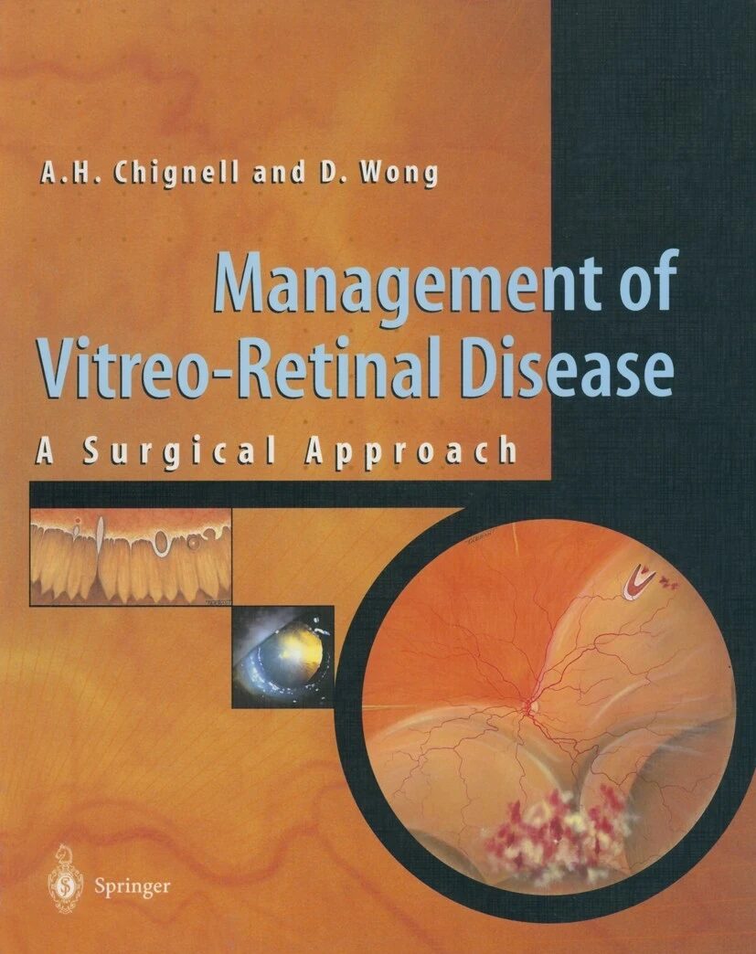 Management of Vitreo