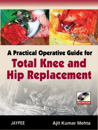 A Practical Operative Guide for Total Knee and Hip Replacement (With DVD Rom)