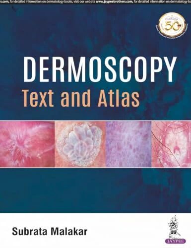 Dermoscopy