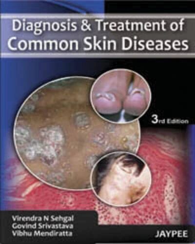 Diagnosis and Treatment of Common Skin Diseases