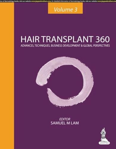 Hair Transplant 360