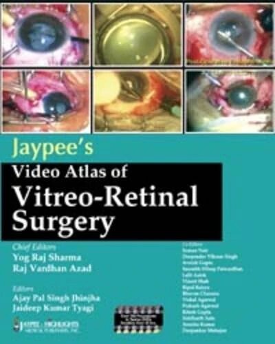 Jaypee's Video Atlas of Vitreo