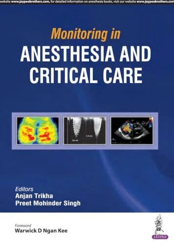 Monitoring in Anesthesia and Critical Care