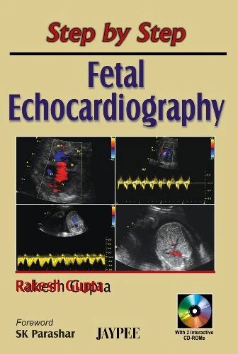 Step By Step Fetal Echocardiography