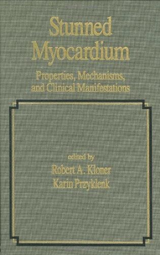 Stunned Myocardium