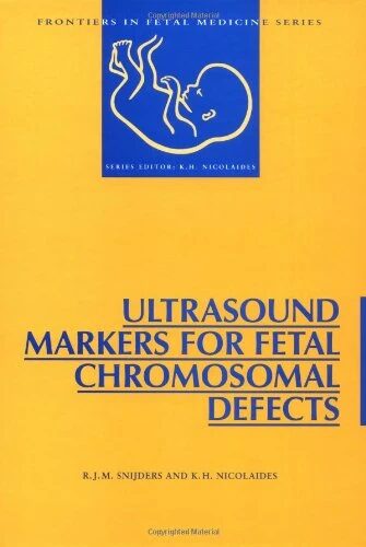 Ultrasound Markers for Fetal Chromosomal Defects