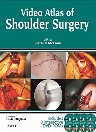 Video Atlas of Shoulder Surgery (DVD)