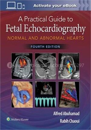 A Practical Guide to Fetal Echocardiography