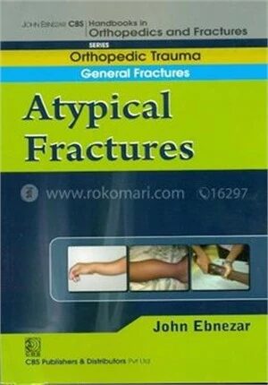 A Typical Fractures