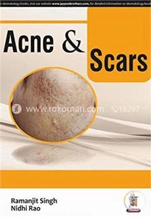 Acne and Scars