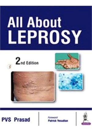 All About Leprosy