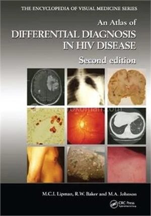 An Atlas of Differential Diagnosis in HIV Disease