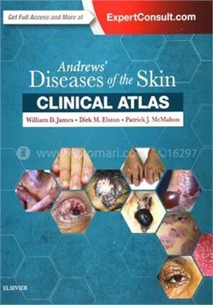 Andrews' Diseases of the Skin Clinical Atlas