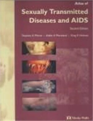 Atlas Of Sexually Transmitted Diseases And Aids
