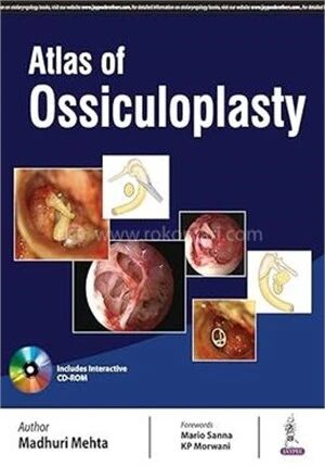 Atlas of Ossiculoplasty