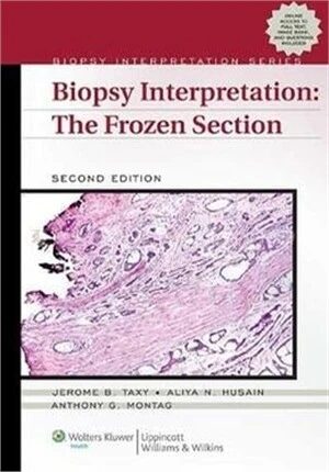 Biopsy Interpretation