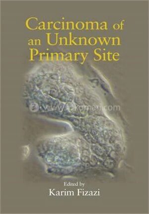 Carcinoma of an Unknown Primary Site