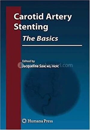 Carotid Artery Stenting
