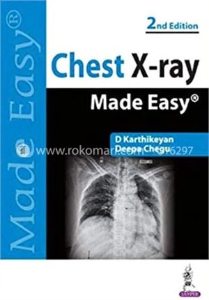 Chest X