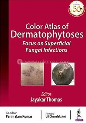 Color Atlas of Fungal Infections
