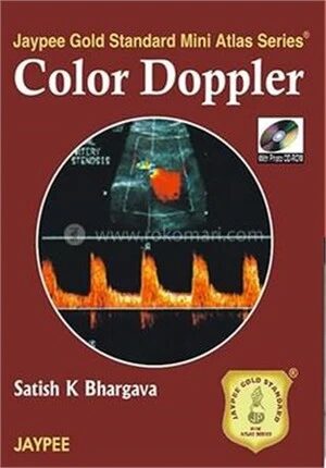 Color Doppler