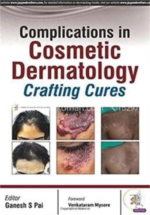 Complications In Cosmetic Dermatology