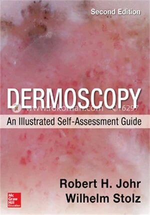 Dermoscopy