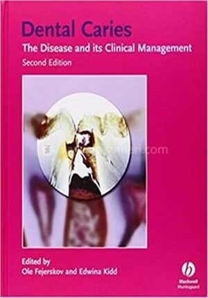 Dental Caries