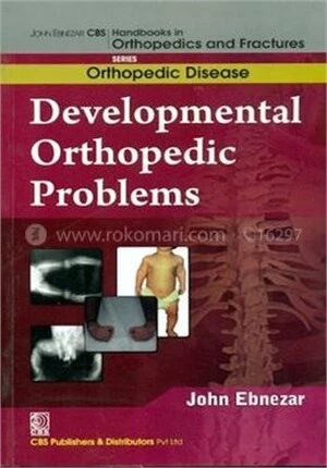 Developmental Orthopedic Problems