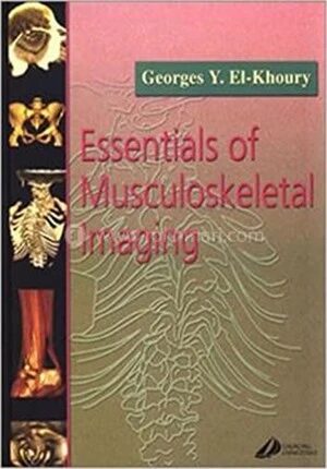 Essentials of Musculoskeletal Imaging