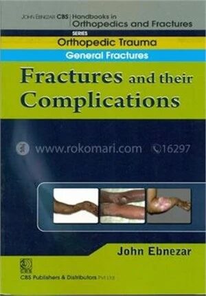 Fractures and Their Complications