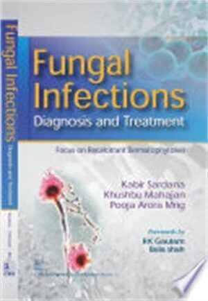 Fungal Infections