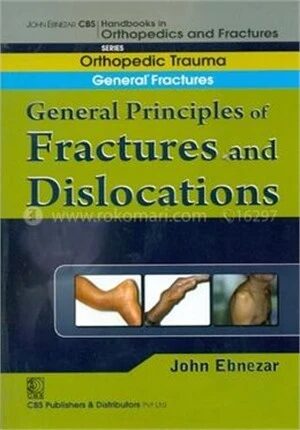 General Principles of Fractures and Dislocations