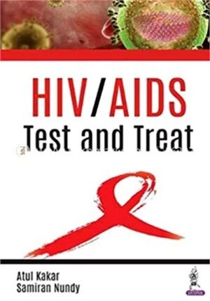 HIV,AIDS