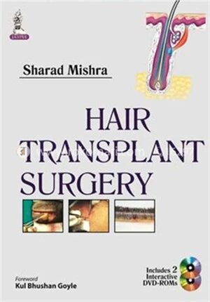 Hair Transplant Surgery