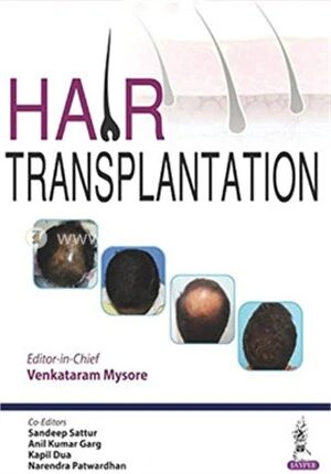 Hair Transplantation