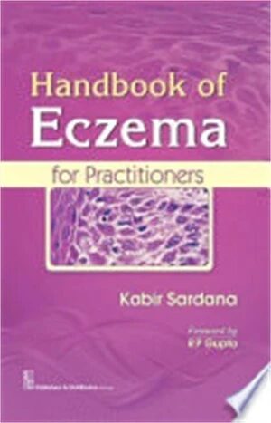 Handbook of Eczema