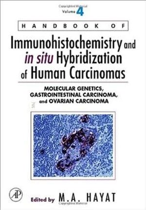Handbook of Immunohistochemistry and in situ Hybridization of Human Carcinomas