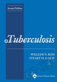 Tuberculosis