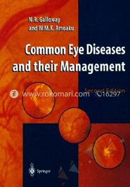 Common Eye Diseases and their Management