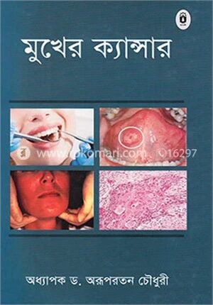 মুখের ক্যান্সার