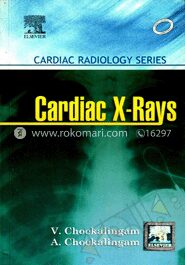 Cardiac X