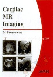Cardiac MR Imaging