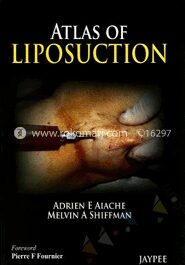 Atlas of Liposuction