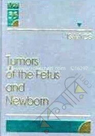 Tumors Of The Fetus And Newborn