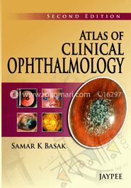 Atlas Of Clinical Ophthalmology