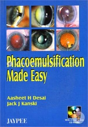 Phacoemulsification Made Easy