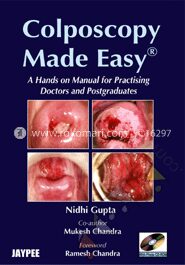 Colposcopy Made Easy (with Photo CD Rom)