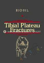 Tibial Plateau Fractures