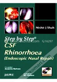CSF Rhinorrhoea